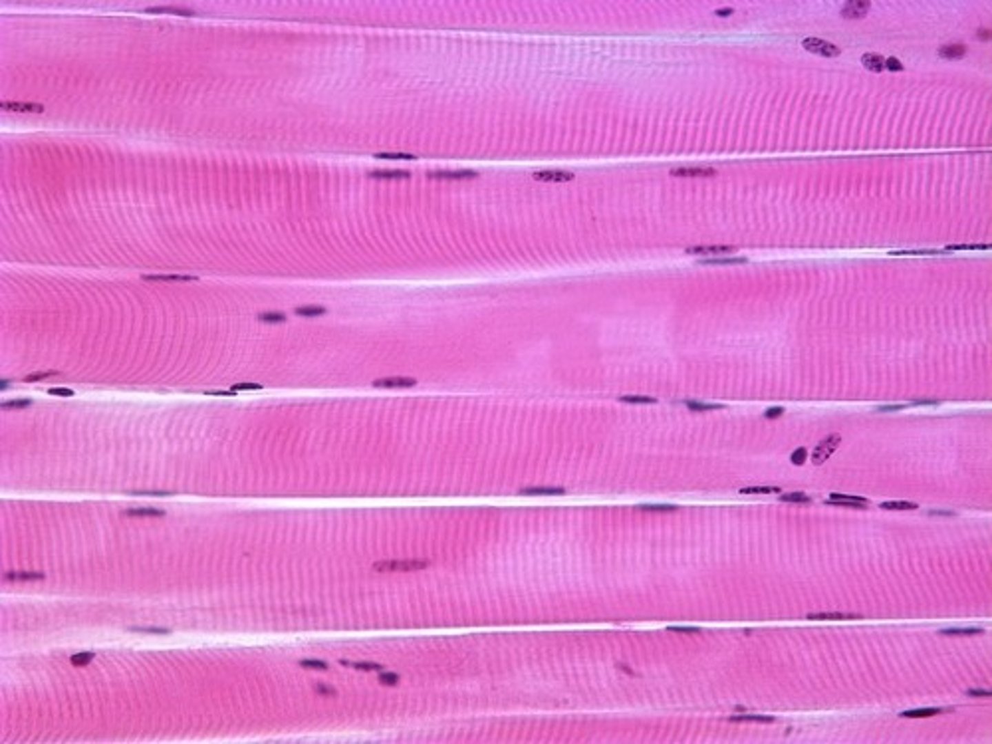 <p>Cells are very straight</p>