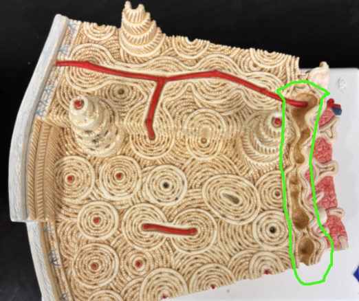 <p>What bone tissue is in the green circle?</p>