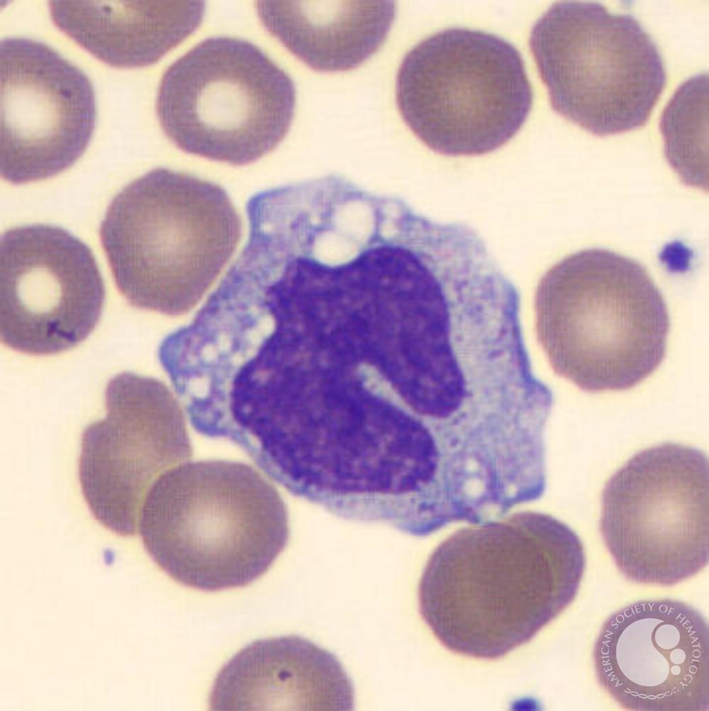 <p>agranulocyte</p><p>phagocytosis</p>