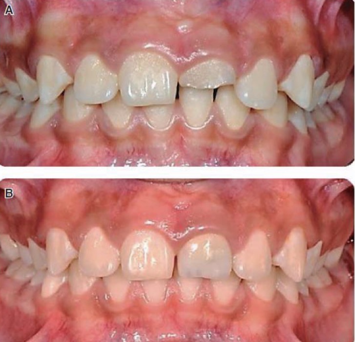 <p>What dental specialty is being displayed here?</p>