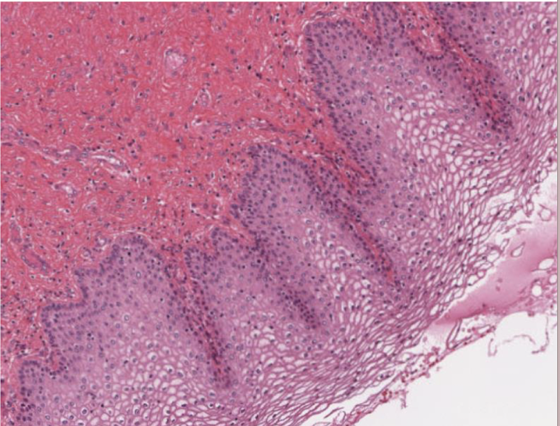 <p>What kind of tissue is this?</p>
