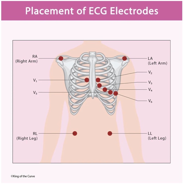 <p>V5 Placement </p>