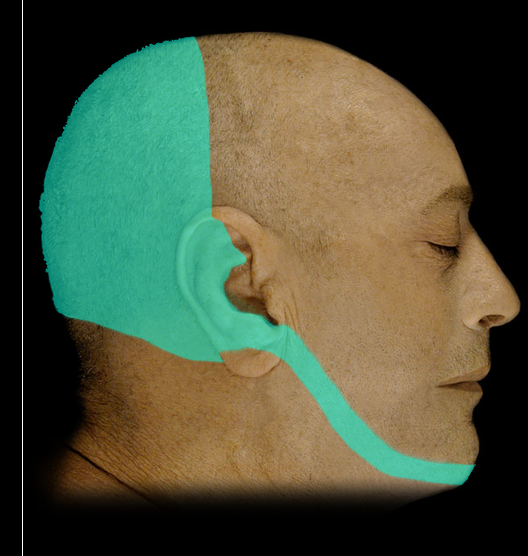 <p>C2 Dermatome</p>