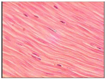 <p>Smooth Muscle</p>