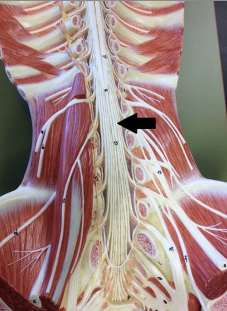 <p>collection of lumbosacral and coccygeal spinal nerves located within the subarachnoid space inferior to the conus medullaris</p>