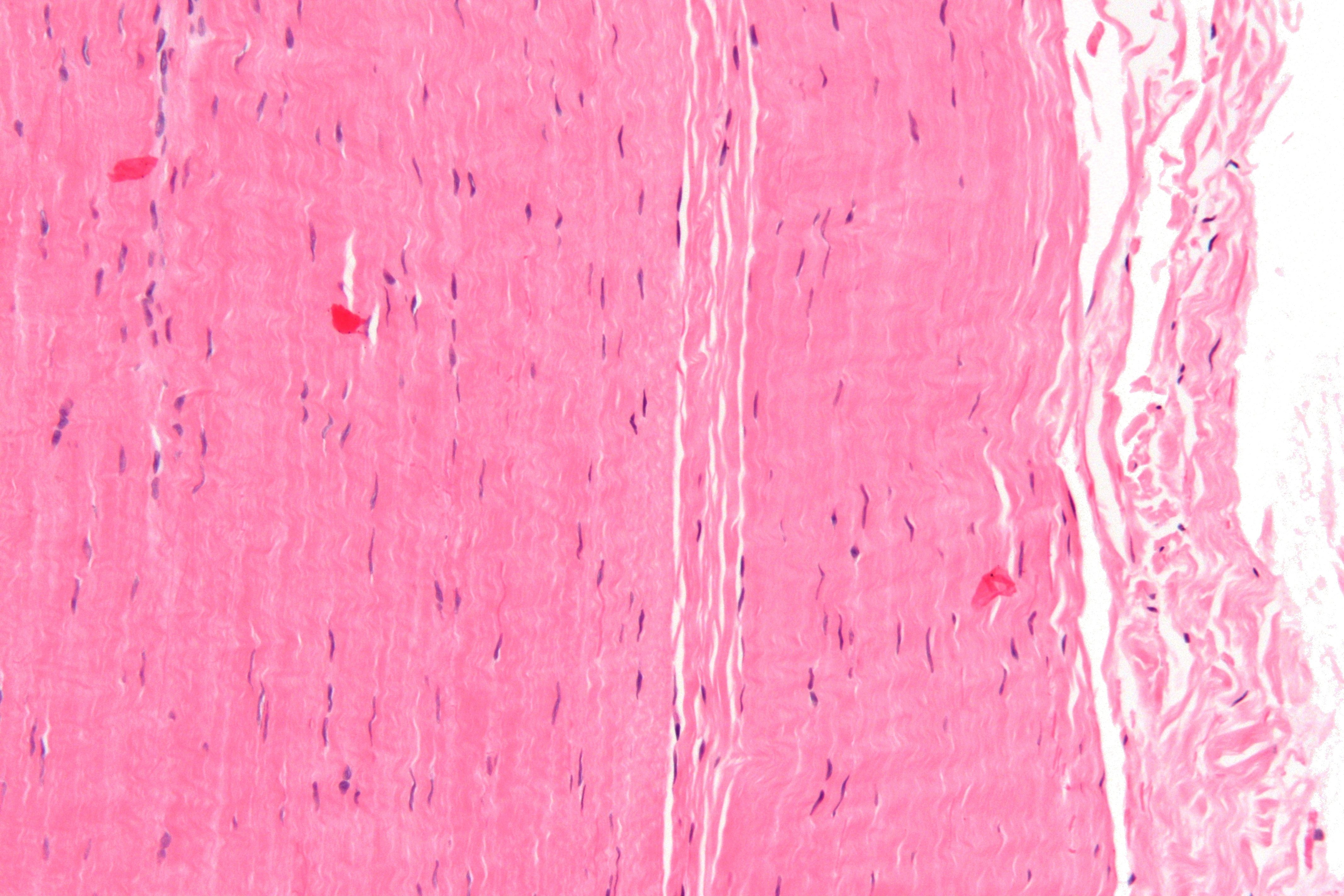 <p>Tendons</p>