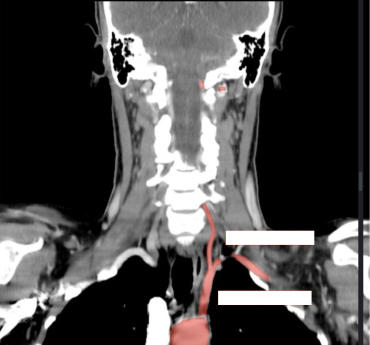 <p>What arteries are these? </p>