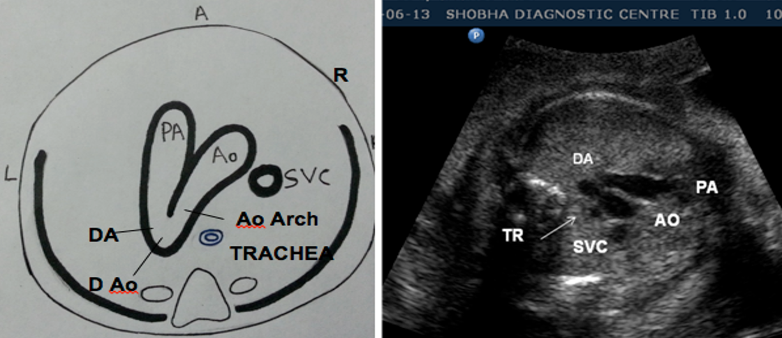 <p>they should be relatively the same size</p>