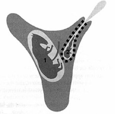 <p>Describe this pregnancy</p>