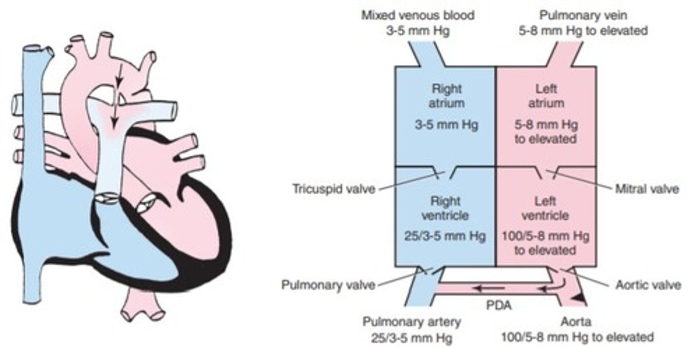<p>a. coarctation of the aorta</p><p>b. aortic stenosis</p><p>c. transposition of the great vessels</p><p>d. ventricular septal defect</p>
