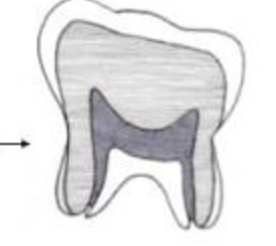 <p>_________ are low crowned molars (Ex: Humans)</p>