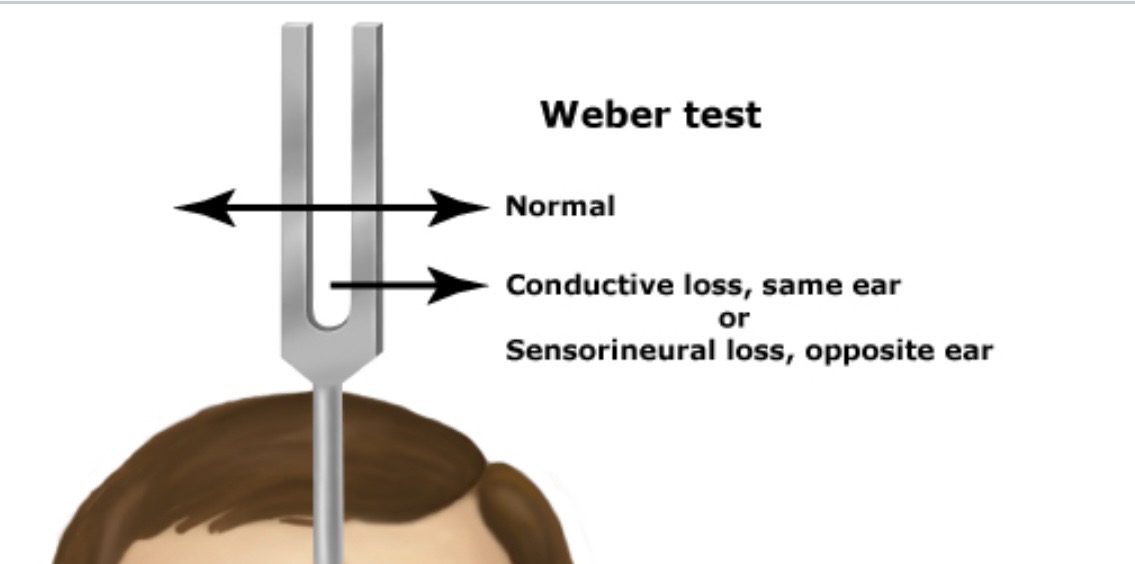<p>Webber Test</p>