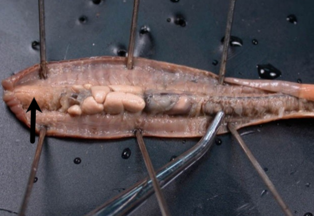 <p><span>Which structure is indicated by the arrow?</span></p>