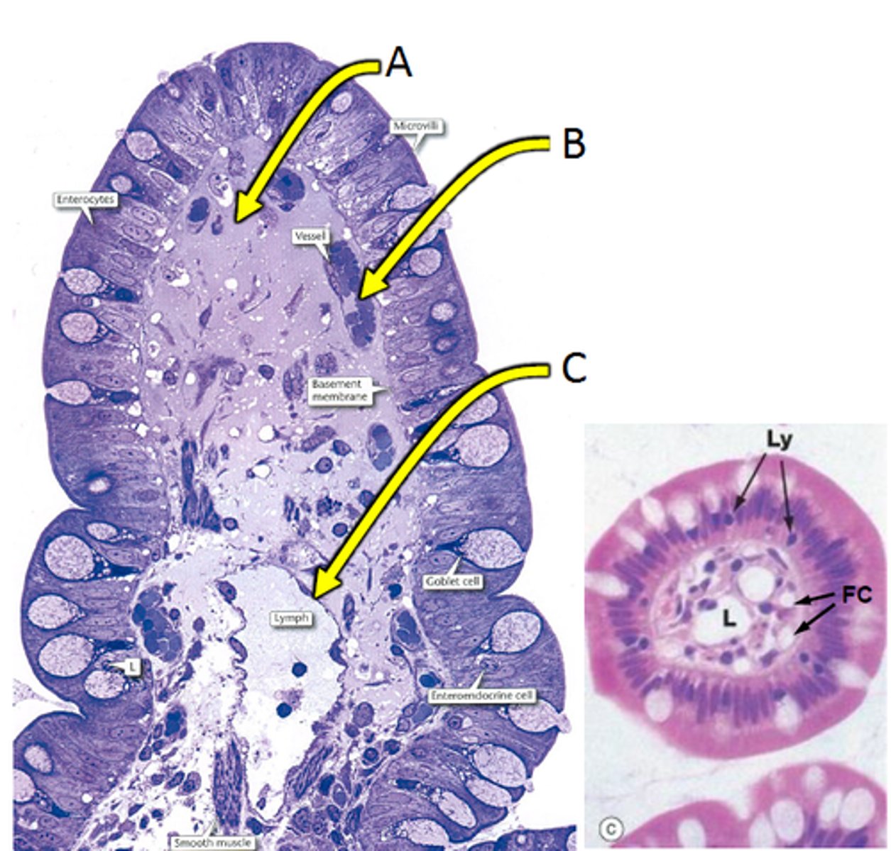 <p>mast cells or H. pylory</p>