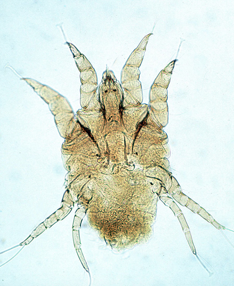 <p>Surface dwelling mite</p><p>Reportable to State Vet &amp; 16 USDA</p>