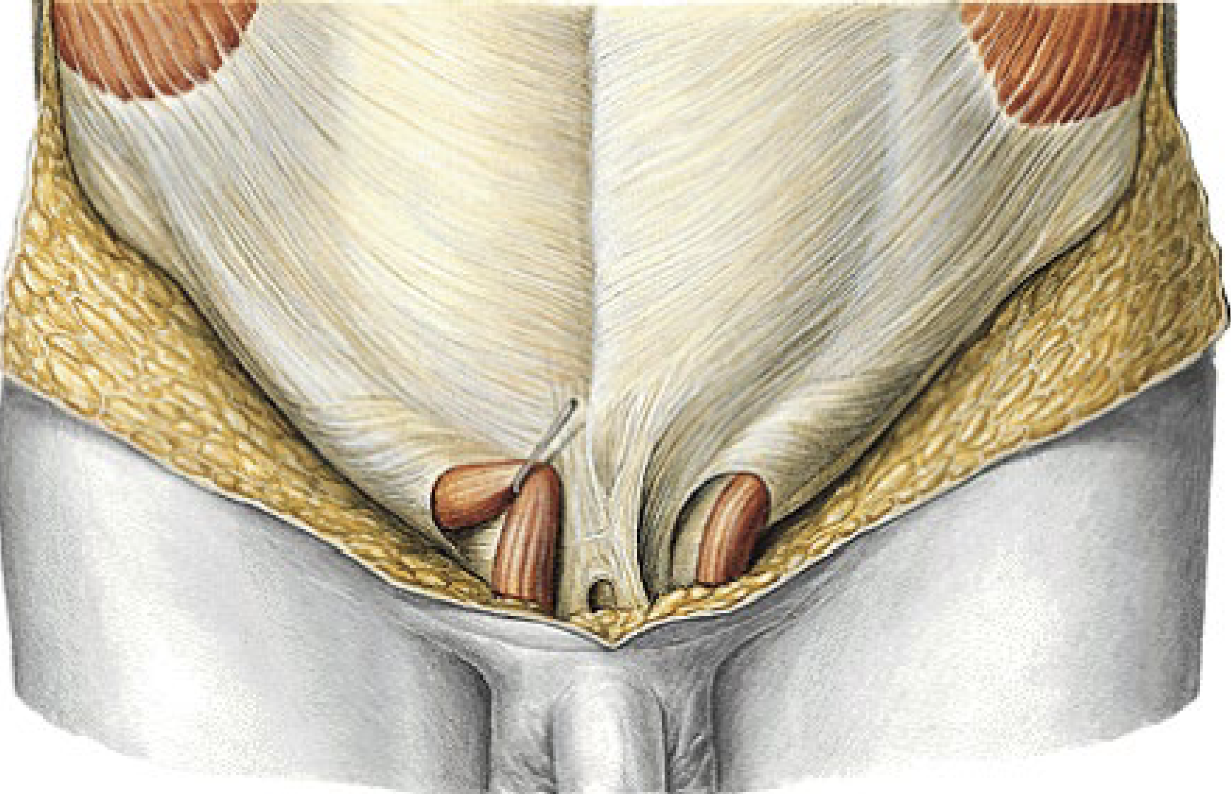 <p>What is the junction between anterior and abdominal wall and thigh?</p>