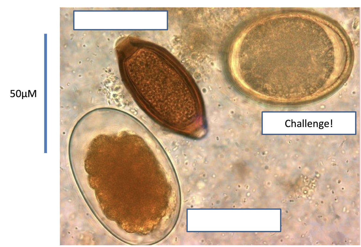 <p>which three helminth species are seen in this image? (left to right)</p>