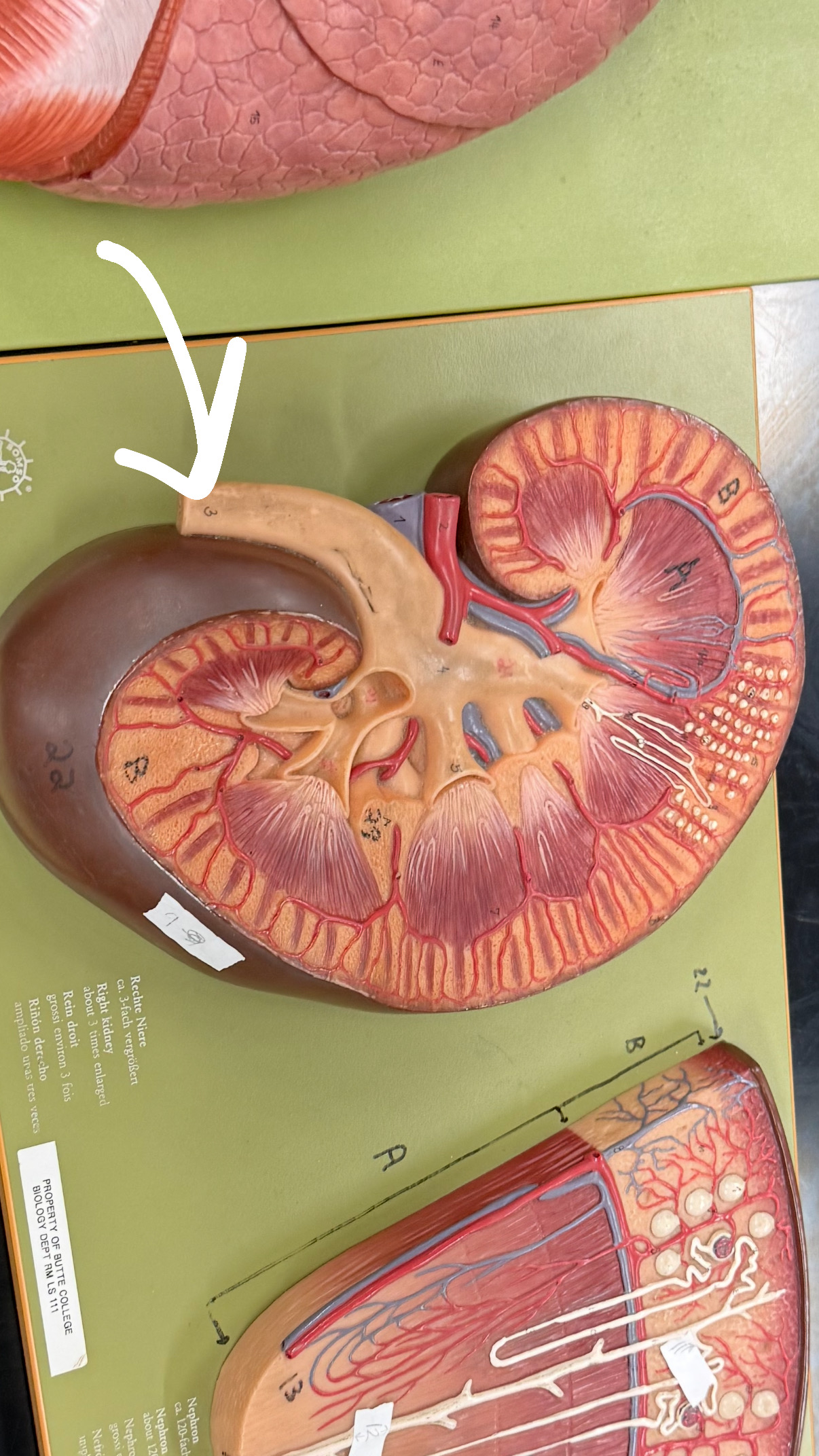 <p>thinner part of the renal pelvis</p>