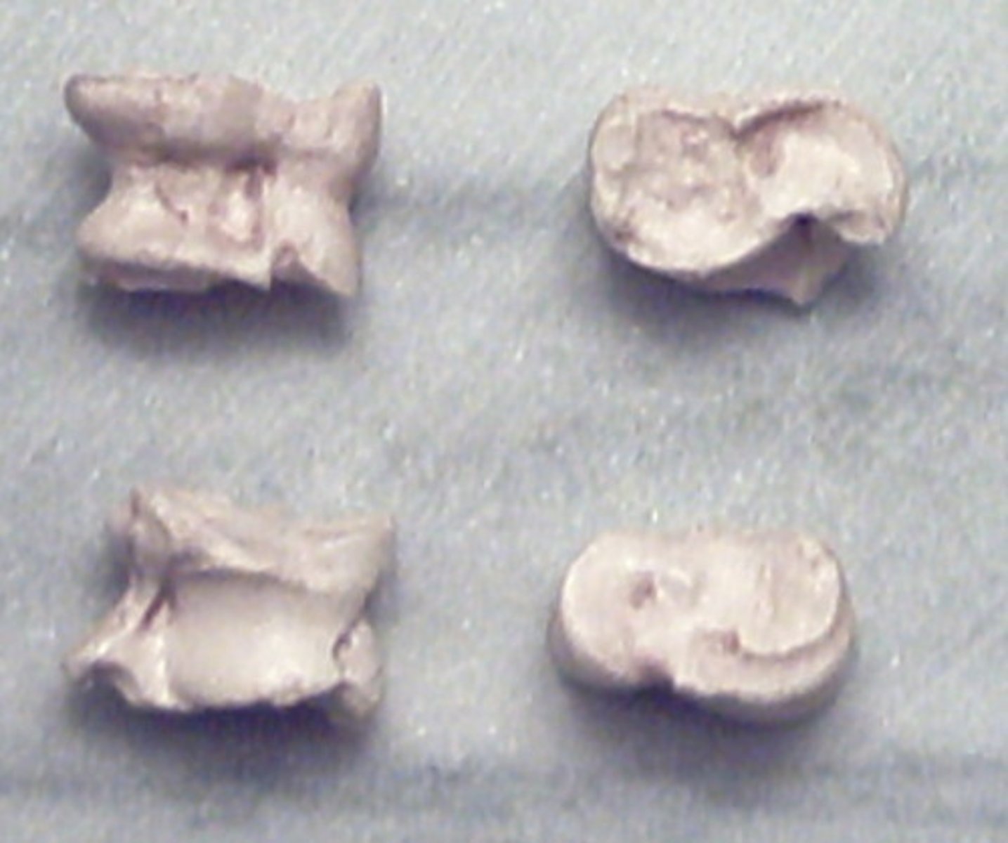 <p>Ex: Trapezoid, wrist bone</p>