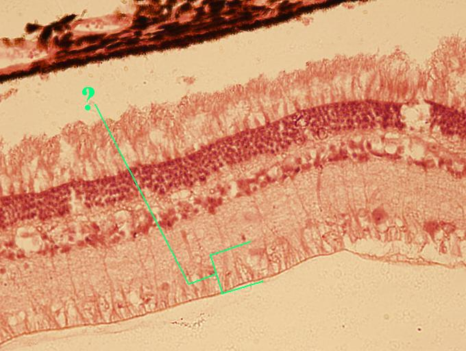 <p>Identify the indicated layer of the retina</p>