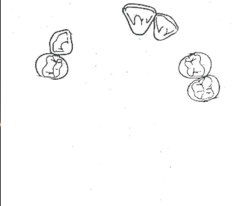 <p>What is the kennedy/applegate classification?</p>
