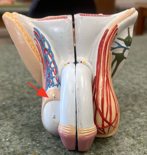 <p>a compartment external to the pelvic cavity that supports and protects the testes</p>