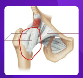 <p>what ligament is circled red?</p>