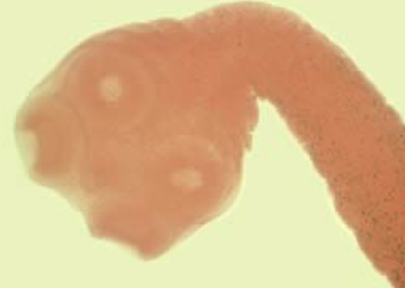 <p>What helminth is this?</p>