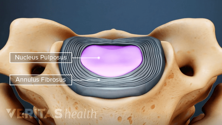 <p>Intervertebral Discs </p><ul><li><p>Within C2/S1</p></li></ul><p></p>
