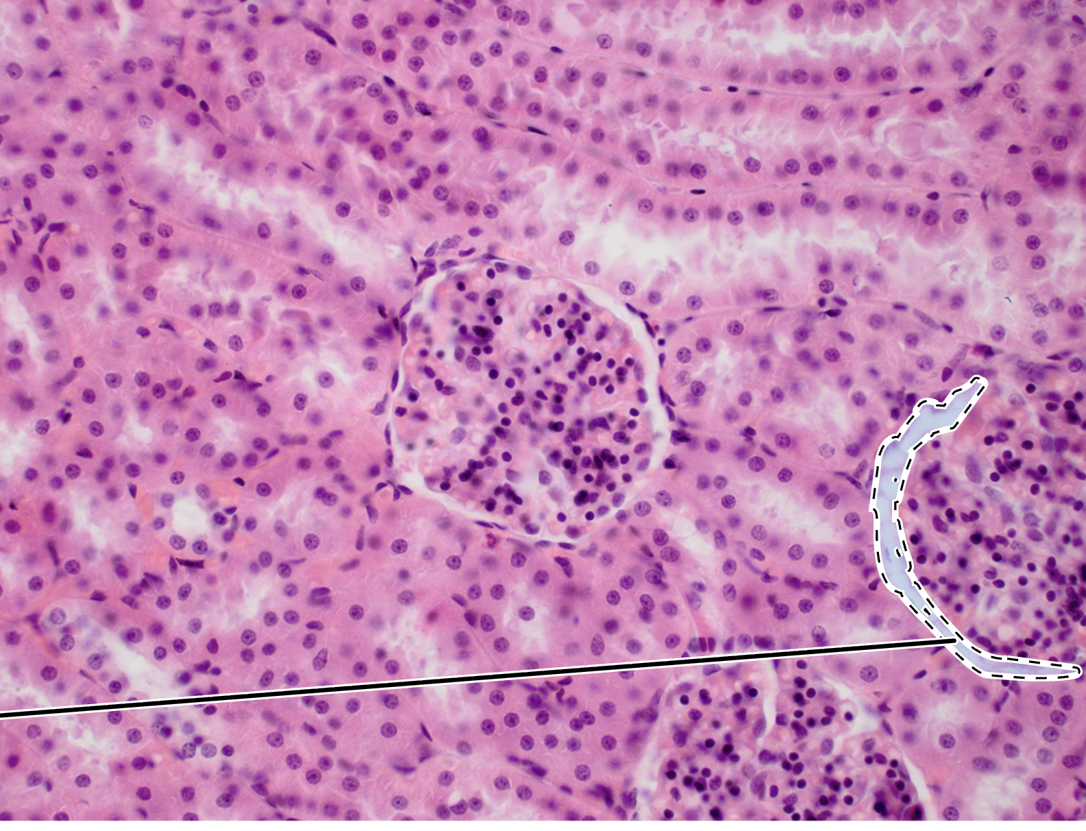 <p>(surrounds glomerulus’)</p>