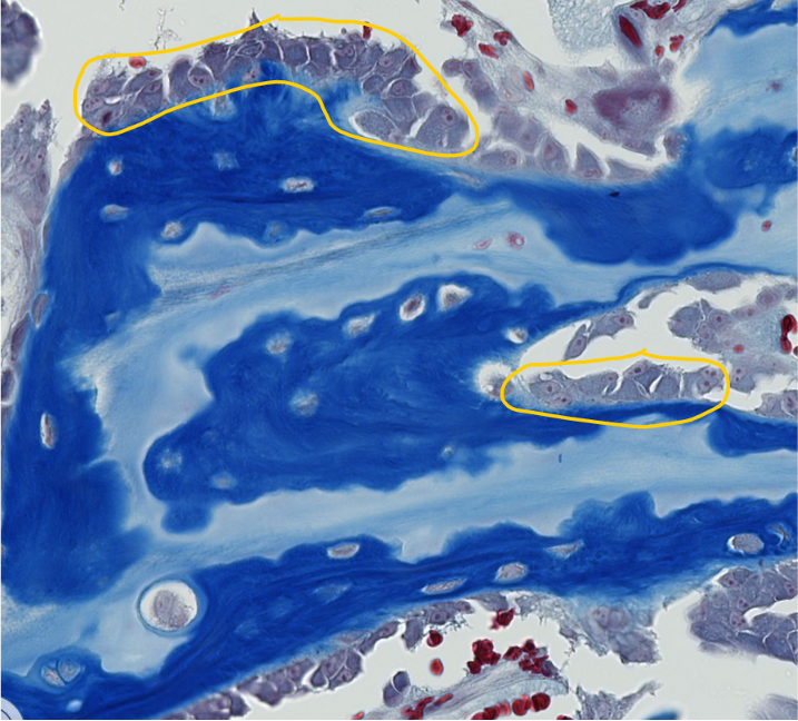 <p><span style="font-family: "Calibri Light";">ID the encircled bone cells.</span></p>