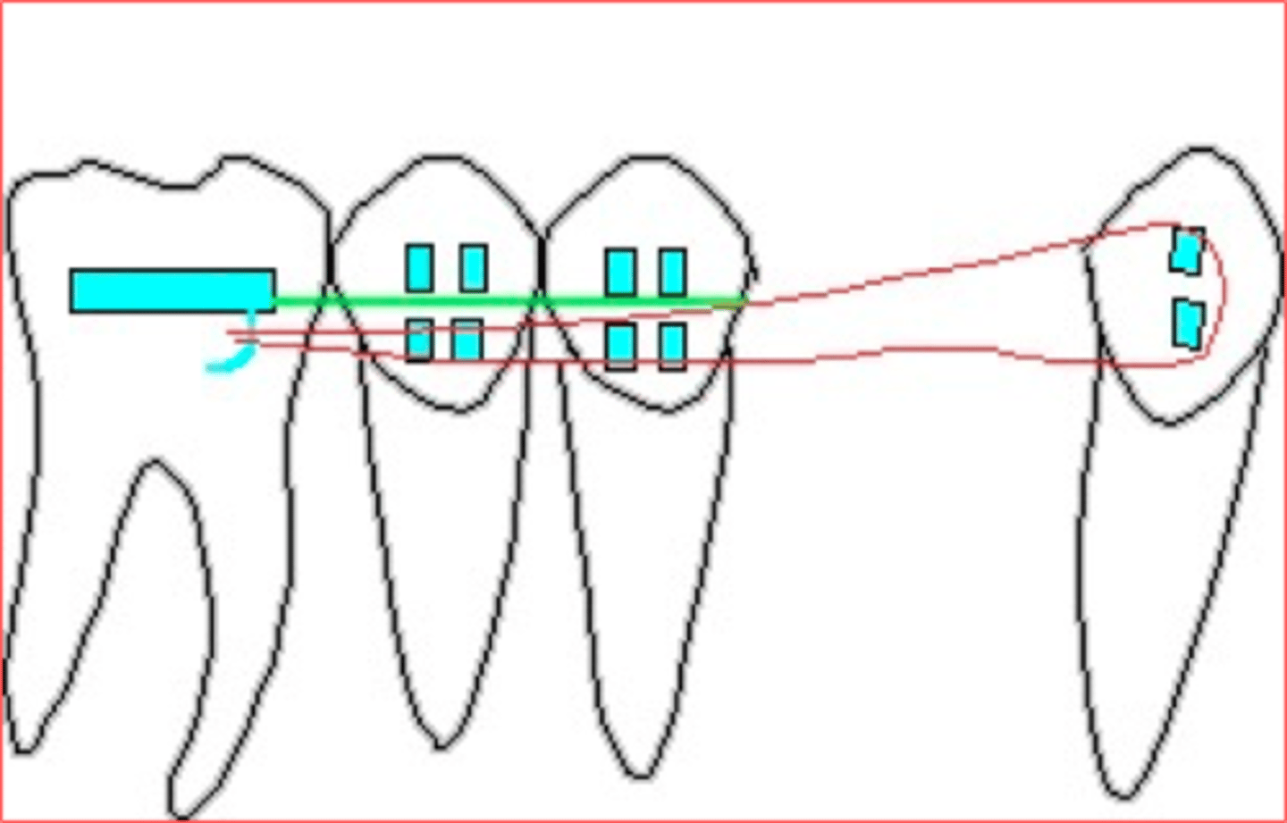 <p>ID the elastics class:</p>