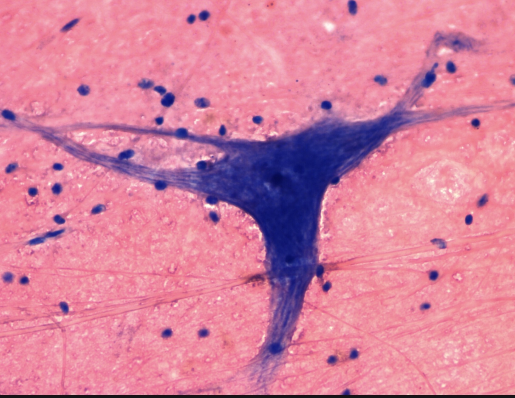 <p>what are the spiked coming out of the cell called?</p>