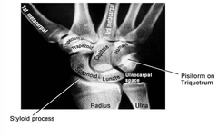 <p>Small range of motion compared to radiocarpal and midcarpal but they do contribute to wrist motion</p>