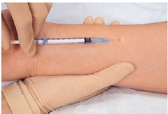 <p>injection</p>