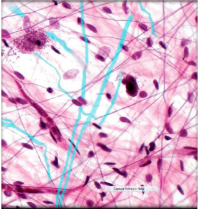 <p>Areolar Connective Tissue</p>