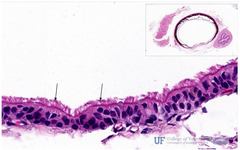 <p>What structure are the arrows pointing to in this slide of a bat trachea?</p>