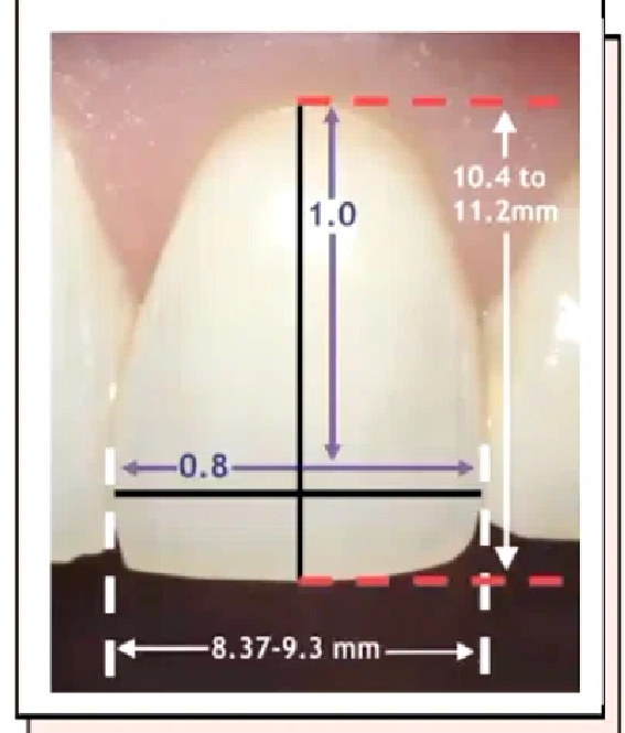 <p>width about 80% of height </p>