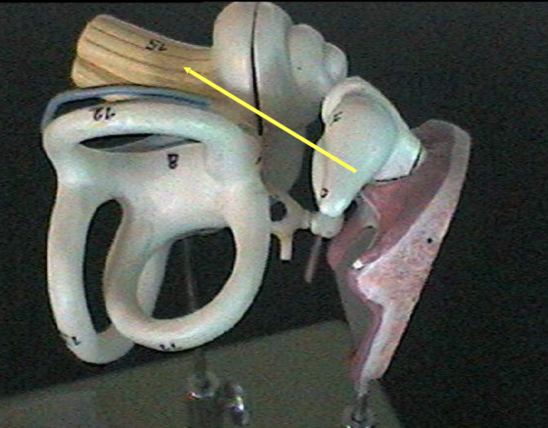 <p>Identify the inner ear parts. </p>