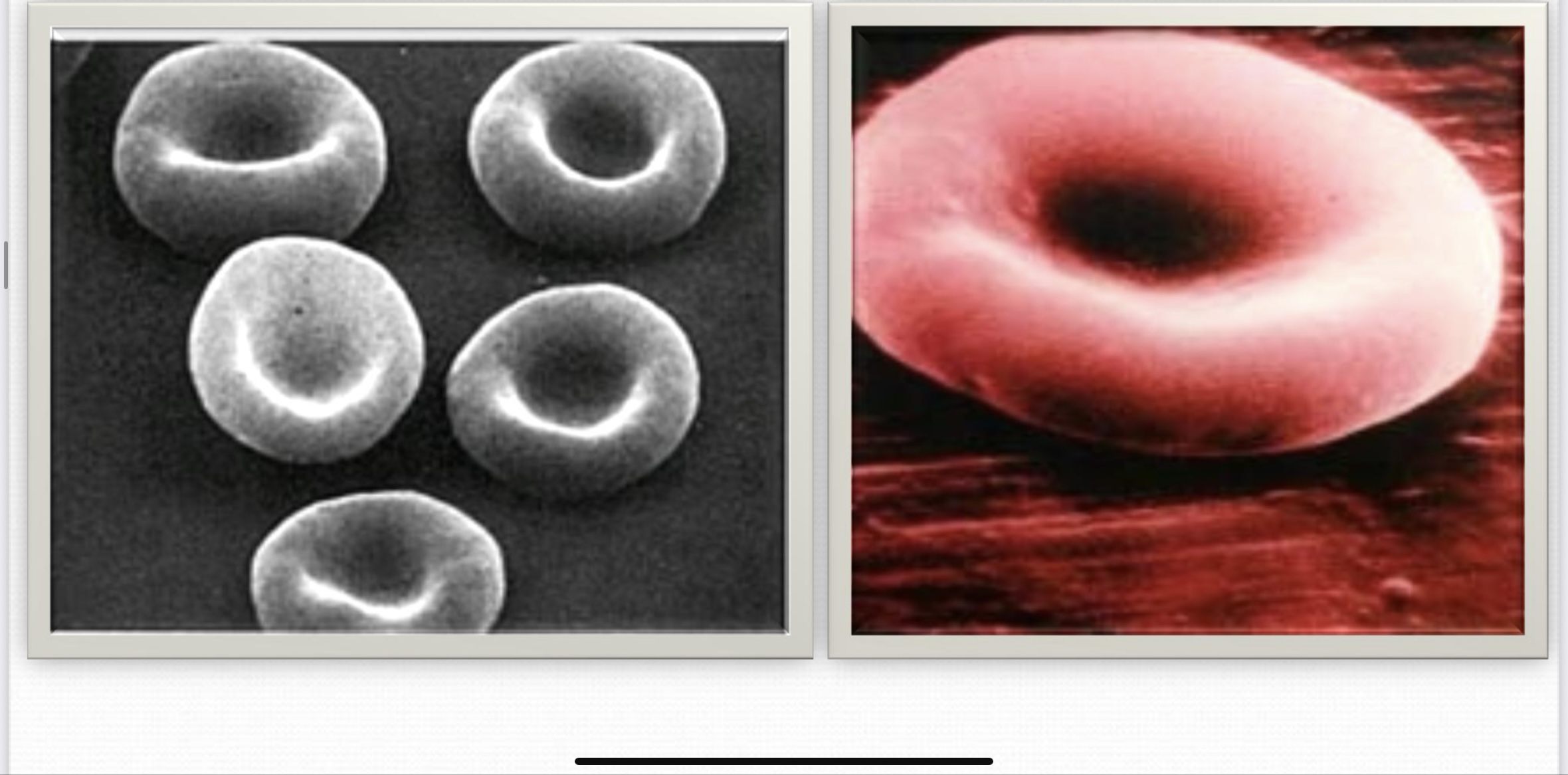 <p>Mesenchymal Connective Tissue</p>