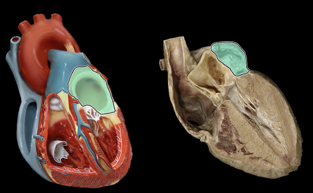 <p>Identify the feature of the heart</p>