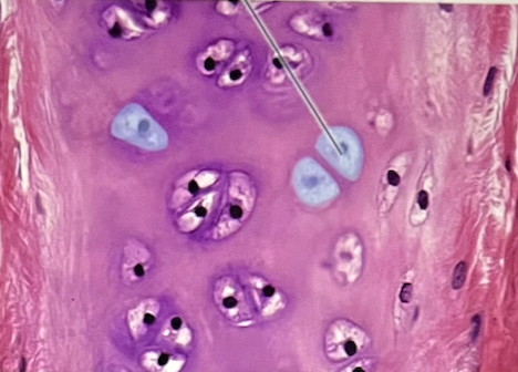 <p>Identify the highlighted spaces that the cells are sitting in</p><p>a. central canals</p><p>b. canaliculi</p><p>c. adipocytes</p><p>d. lacunae</p><p>e. lamellae</p>