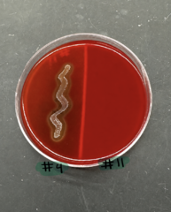 <p>this bacteria was plated and incubated on a sheep blood agar. what type of hemolysis does #11 exhibit?</p>