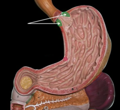 <p>prevents reflux of food back into the esophagus</p>