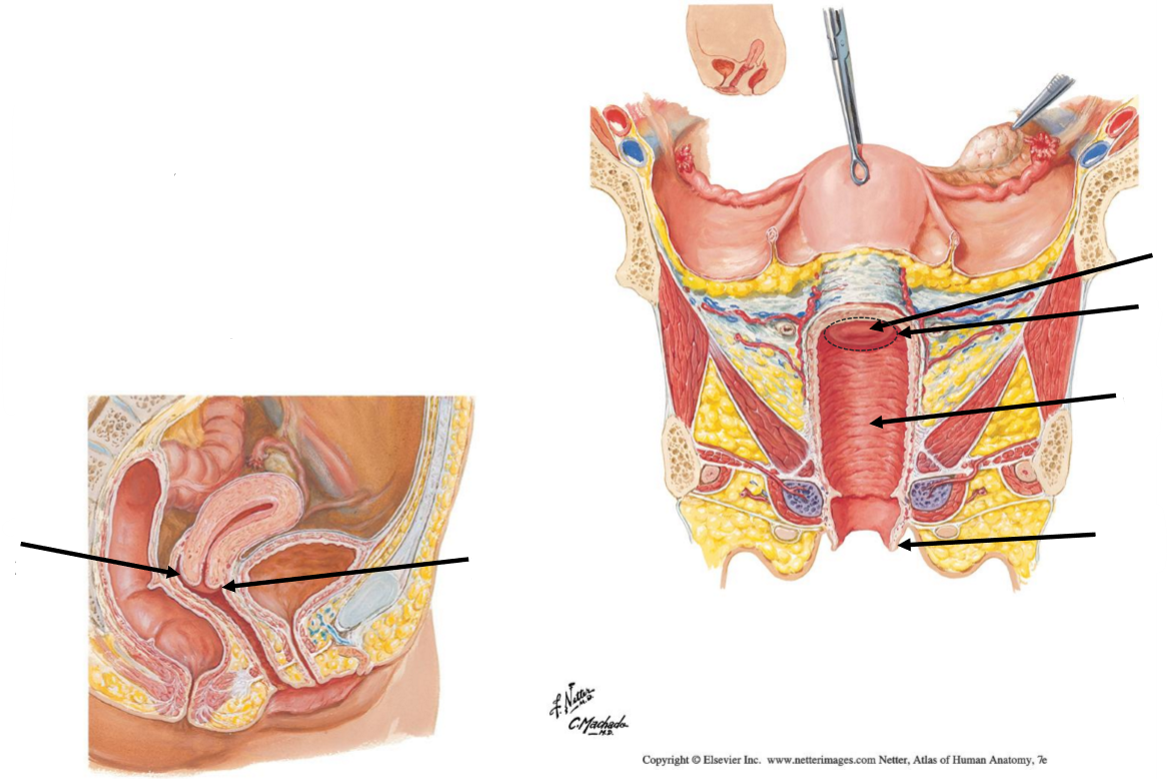 <p>Label the following diagram of the <strong>vag!na</strong></p>