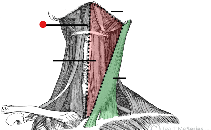 <p>Identify the structure pinned </p>