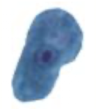 <p>What Amebae is this? Is this the trophozoite or cyst form?</p>