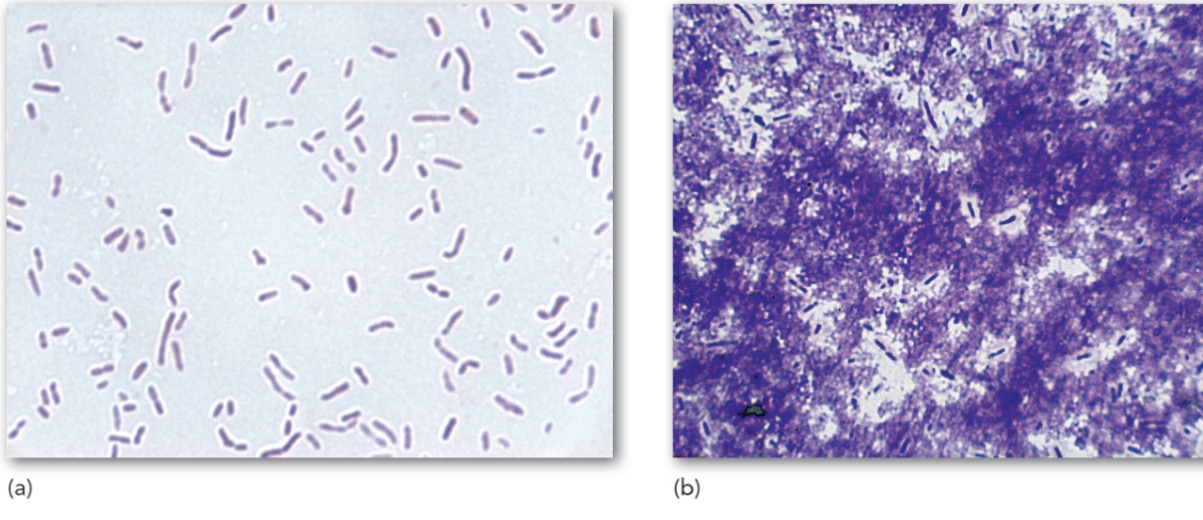 <p>Capsule stain</p>