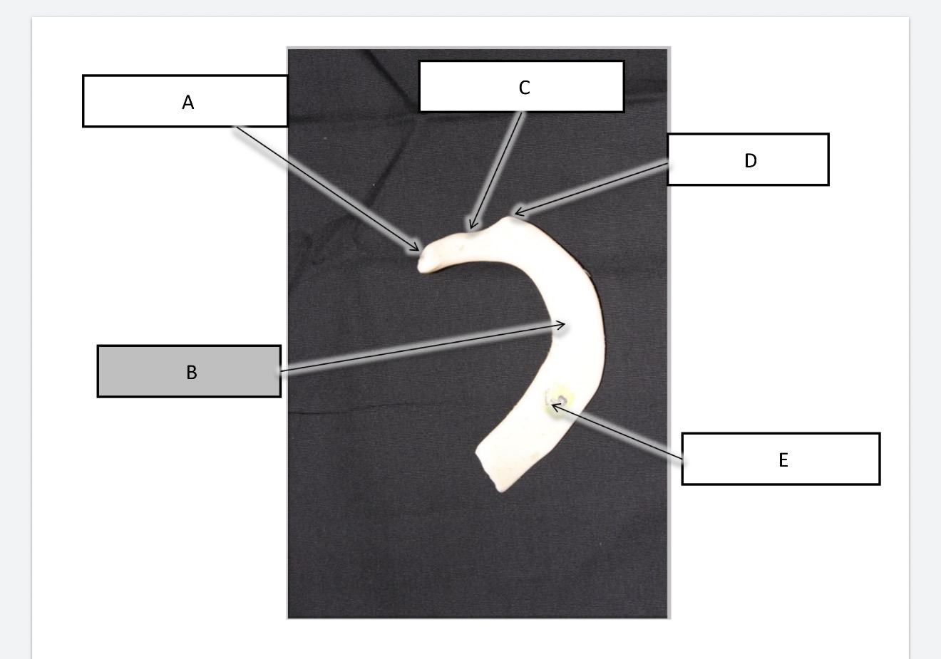 <p>What is B?</p>