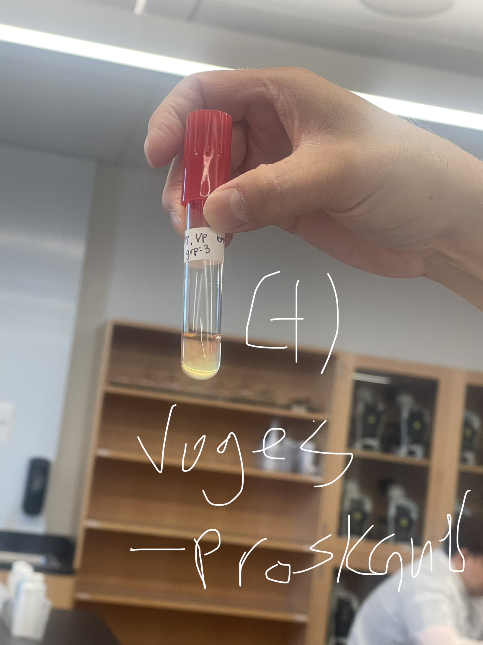 <p><strong>Name: </strong>Voges-Proskauer Test</p><p><strong>PURPOSE: </strong>to determine if your organism ferments glucose into a neutral product called acetoin.</p><p><strong>MEDIA: </strong>glucose supplemented nutrient broth</p><p><strong>INOCULATION GUIDE: </strong>loopful</p><p><strong>INCUBATION: </strong>37°C for 48 hrs.</p><p><strong>THEORY:</strong></p><ul><li><p>glucose is fermented —> neutral product acetoin</p></li><li><p><strong>After incubation, </strong>to detect acetoin, add:</p></li></ul><ol><li><p>Alpha-naphthol(<strong>8 drops</strong>)</p></li><li><p>KOH(<strong>4 drops</strong>) - potassium hydroxide</p></li></ol><p><strong>RESULTS: NEED TO WAIT AT LEAST 15-30 MIN. AFTER ADDING KOH</strong></p><p>(+): <span style="color: red;">red</span></p><p>(-): <mark data-color="#efd819" style="background-color: rgb(239, 216, 25); color: inherit;">yellow </mark>(didn’t have acetoin)</p><p></p>
